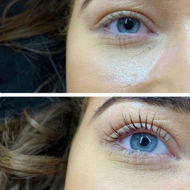 Lash Lifts